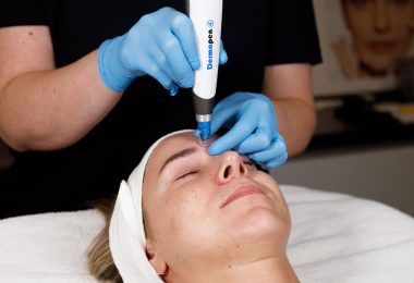Microneelding behandeling bij Dehcos met Dermapen 4